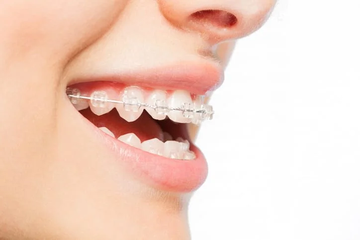 Avance Dental Clinic LLC (Branch photo 4