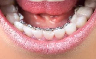 Avance Dental Clinic LLC (Branch photo 5