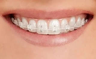 Avance Dental Clinic LLC (Branch photo 6