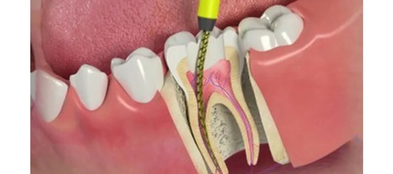 Orthodontix Dental Clinic photo 3