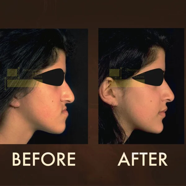 Orthognathic Surgery Centre FZ-LLC photo 1