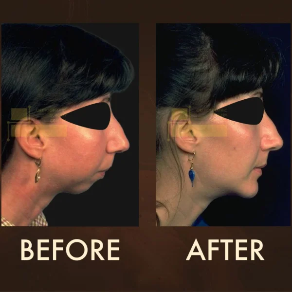 Orthognathic Surgery Centre FZ-LLC photo 2