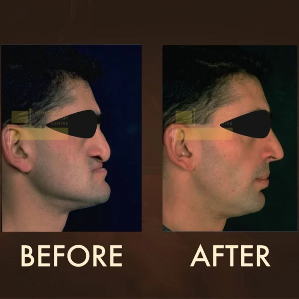 Orthognathic Surgery Centre FZ-LLC photo 6