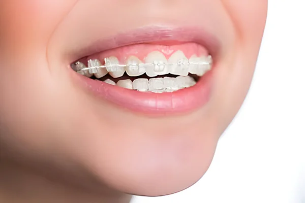 Sahara Dental Clinic And Orthodontic Centre LLC photo 5
