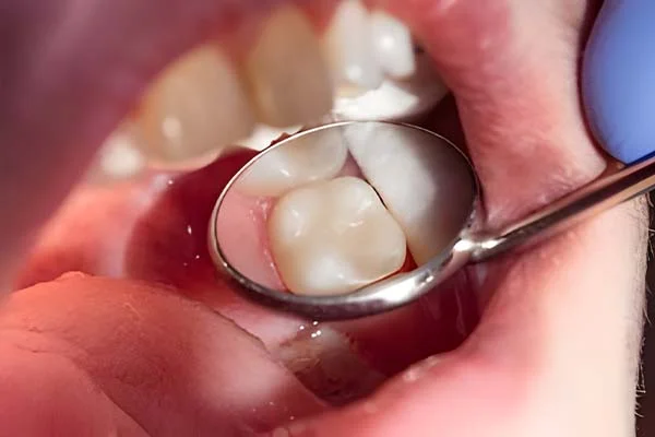 Sahara Dental Clinic And Orthodontic Centre LLC photo 8