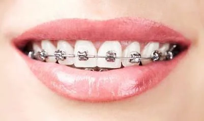 Bright Smile Dental And Orthodontic Center photo 5