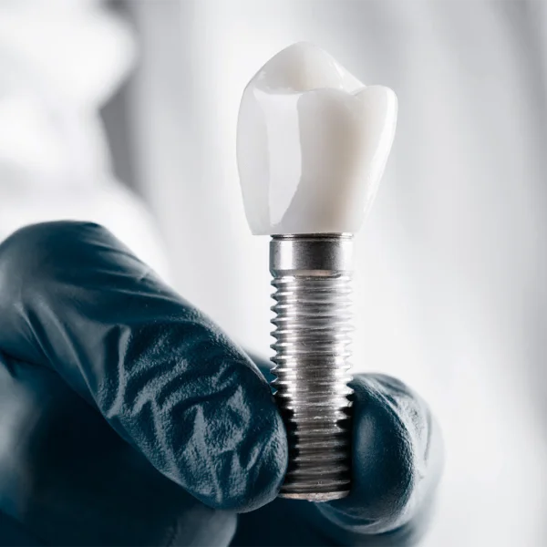 Swedish Dental Clinic photo 6