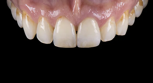 Techno Dent photo 3