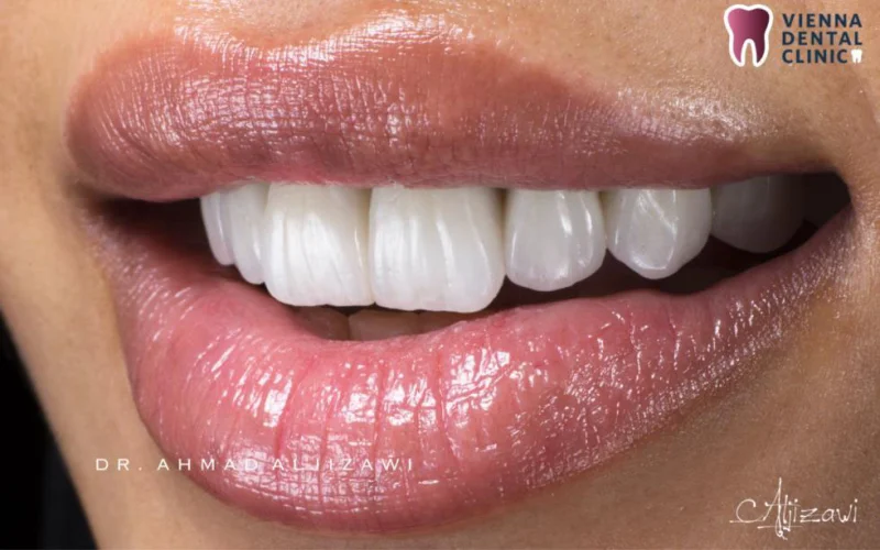Vienna Dental Clinic Fz LLC photo 2