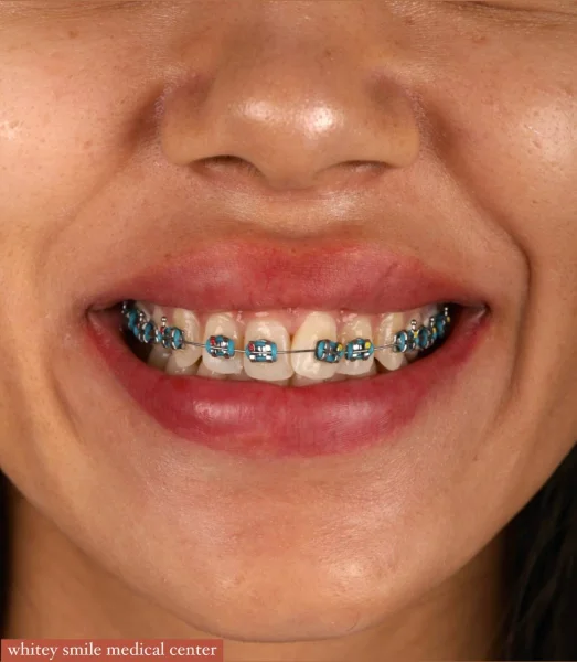 WHITEY SMILE MEDICAL CENTER photo 5