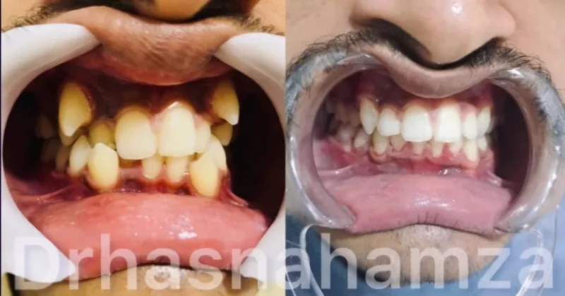 DR HASNA DENTAL CLINIC photo 6