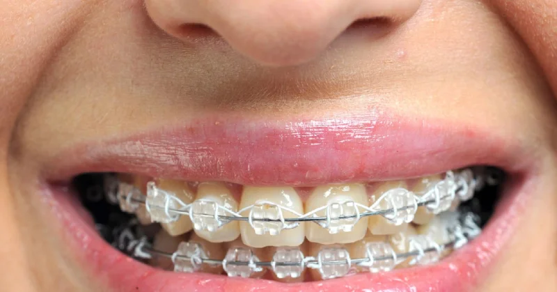 DR HASNA DENTAL CLINIC photo 8