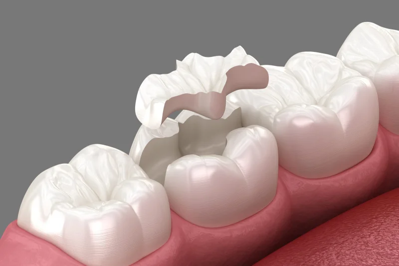 AL BALSAM DENTAL CENTER photo 5