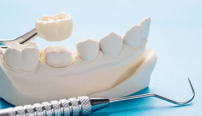 HOLLYWOOD SMILE FOR DENTISTRY photo 5