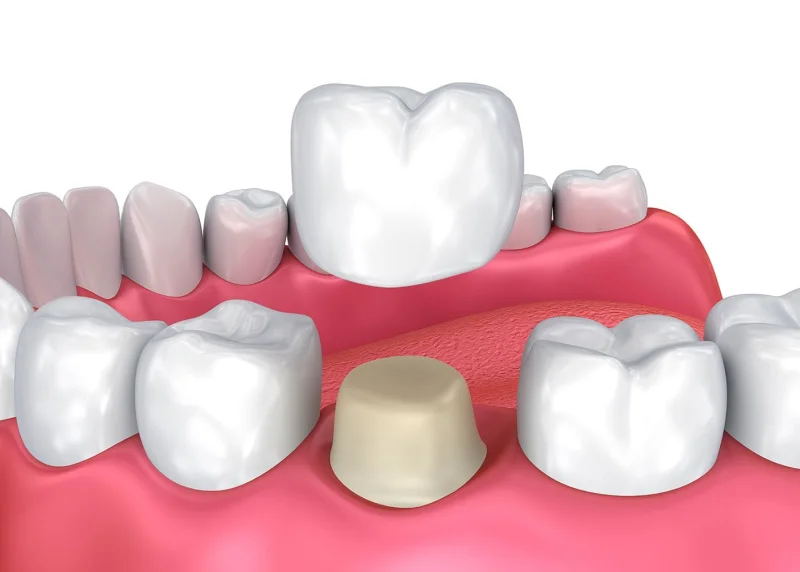 HOLLYWOOD SMILE FOR DENTISTRY photo 6