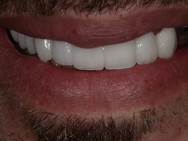 AL LULUA AL BAIDHAA DENTAL CLINIC photo 4