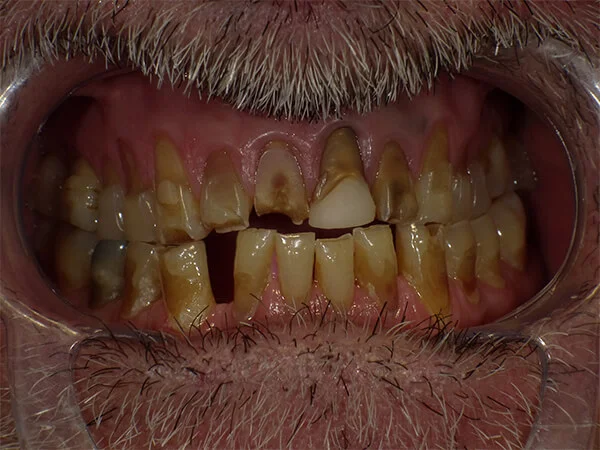 AL LULUA AL BAIDHAA DENTAL CLINIC photo 5