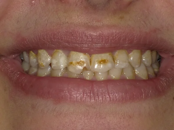 AL LULUA AL BAIDHAA DENTAL CLINIC photo 7