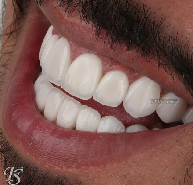 THE TOPDENT POLY CLINIC CO  L L C photo 7