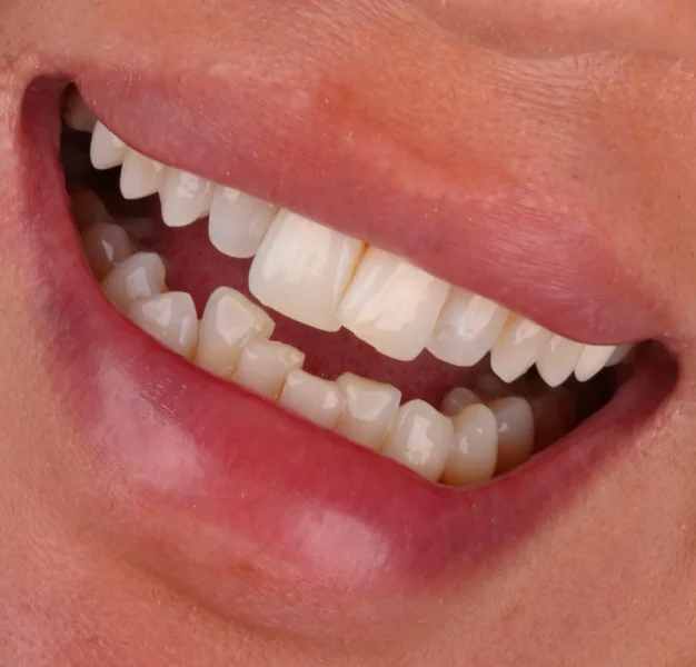 THE TOPDENT POLY CLINIC CO  L L C photo 8