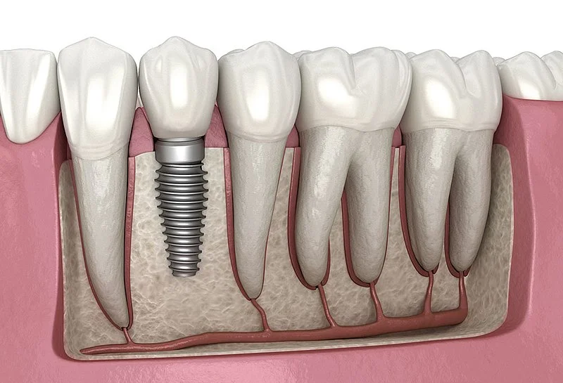 ROSE DENTAL CENTER LLC photo 5