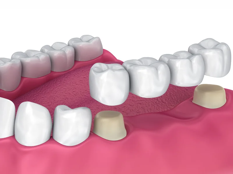 ROSE DENTAL CENTER LLC photo 6