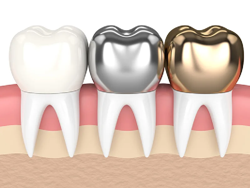 ROSE DENTAL CENTER LLC photo 7
