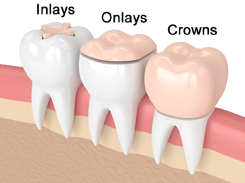 ROSE DENTAL CENTER LLC photo 8