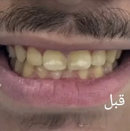 AL HANEEN DENTAL CLINIC photo 1