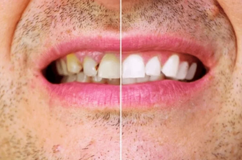 Hollywood Smile Dental Clinic LLC photo 2