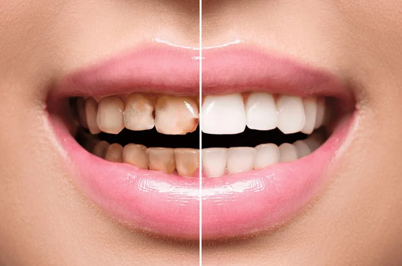 Hollywood Smile Dental Clinic LLC photo 3