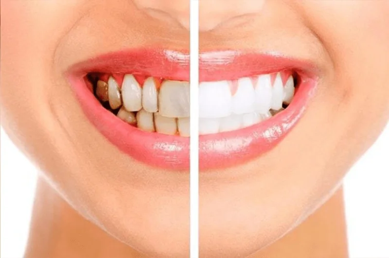 Hollywood Smile Dental Clinic LLC photo 4