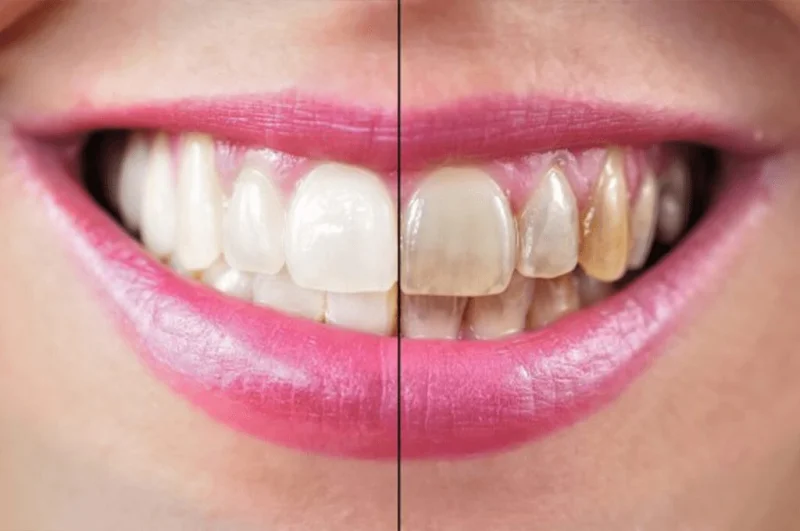 Hollywood Smile Dental Clinic LLC photo 5