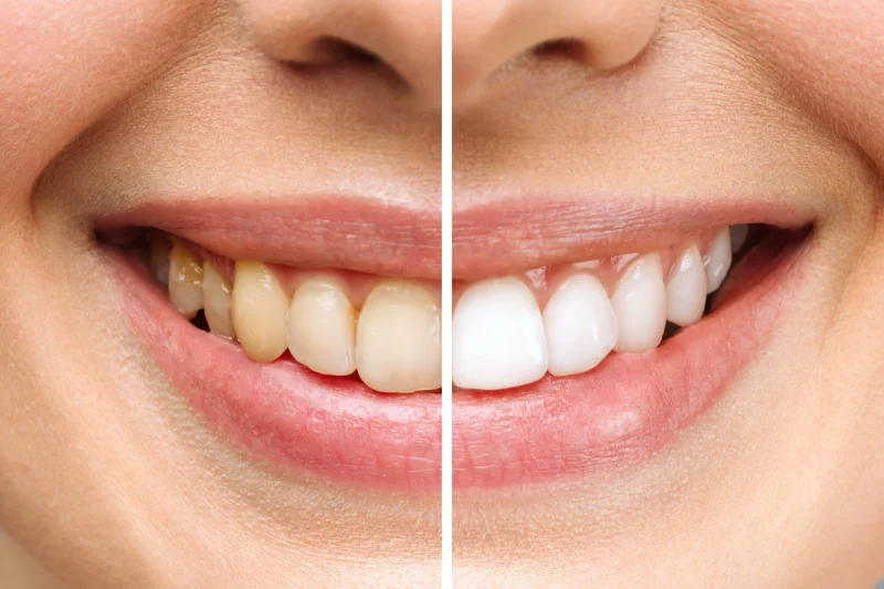 Hollywood Smile Dental Clinic LLC photo 6