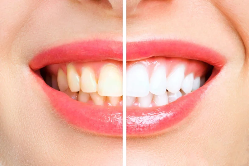 Hollywood Smile Dental Clinic LLC photo 7