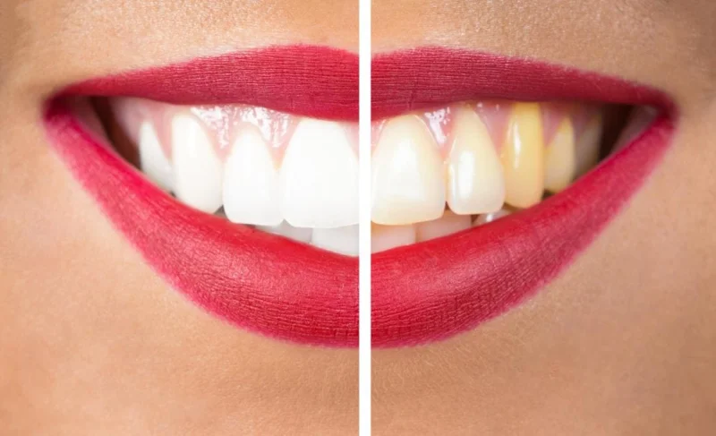 Hollywood Smile Dental Clinic LLC photo 8