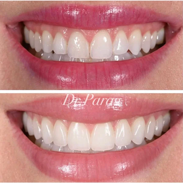 ELITE SMILE DENTAL CLINICS photo 7