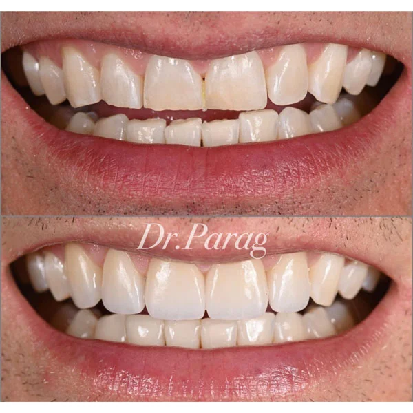 ELITE SMILE DENTAL CLINICS photo 8