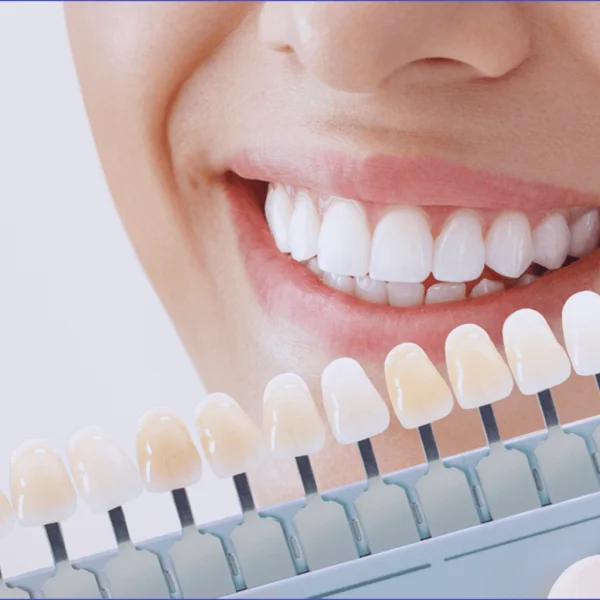 Next Care Dental Clinic L.L.C photo 4