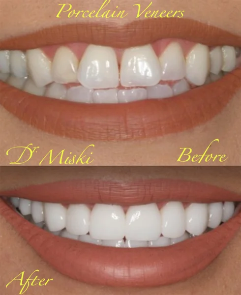 DR MISKIS DENTAL AESTHETIC CENTRE DMCC photo 1