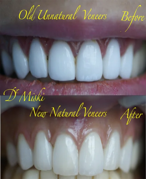 DR MISKIS DENTAL AESTHETIC CENTRE DMCC photo 3