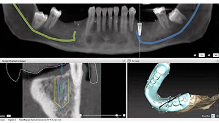 DR MISKIS DENTAL AESTHETIC CENTRE DMCC photo 7