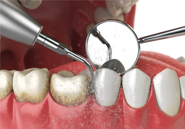 WHITE SMILE DENTAL CENTER L.L.C photo 8