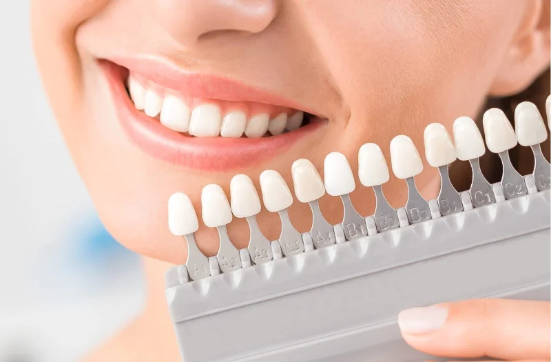 PEARLY SMILE DENTAL CENTER L.L.C - BRANCH 1 photo 2