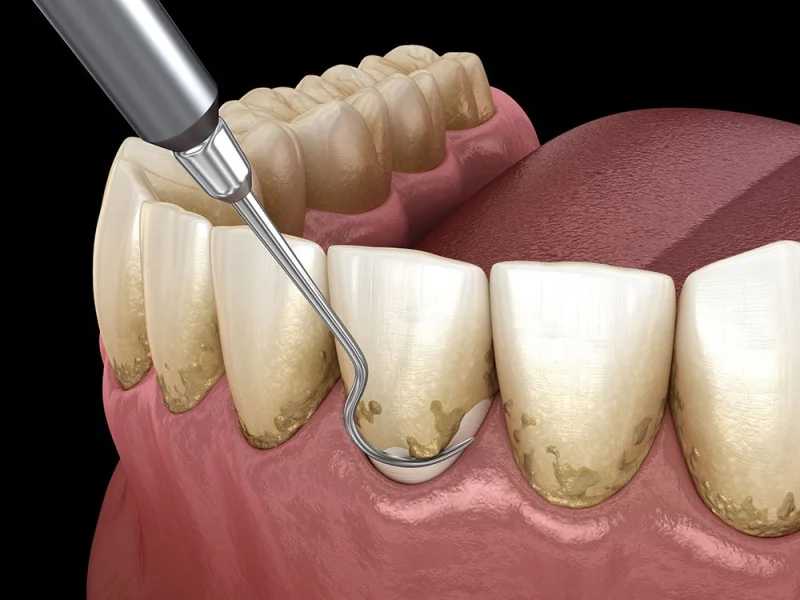 PEARLY SMILE DENTAL CENTER L.L.C - BRANCH 1 photo 4