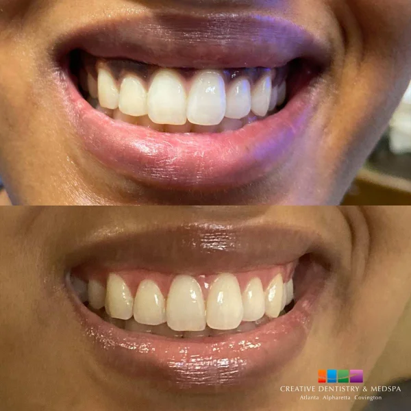 PEARLY SMILE DENTAL CENTER L.L.C - BRANCH 1 photo 5