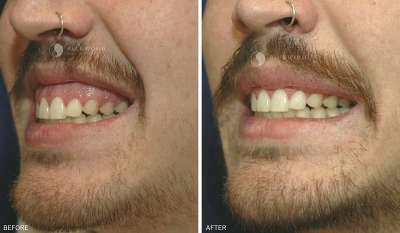 PEARLY SMILE DENTAL CENTER L.L.C - BRANCH 1 photo 6