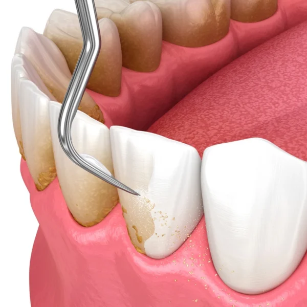 PALERMO DENTAL CENTRE - L.L.C - O.P.C photo 3