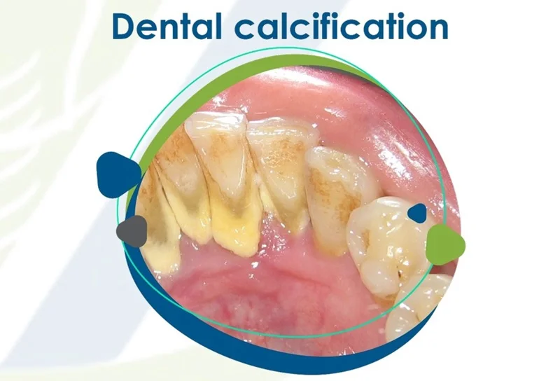 VISION DENTAL CLINIC L.L.C photo 2