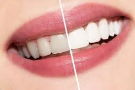 VISION DENTAL CLINIC L.L.C photo 5